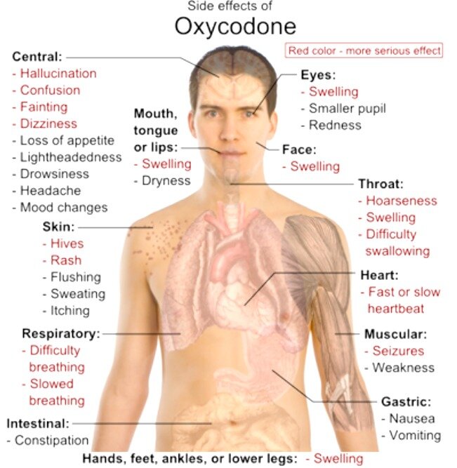 oxycodone-side-effects-addiction